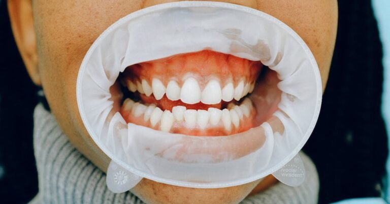 Great Tips For Gaining Your Whitest Smile